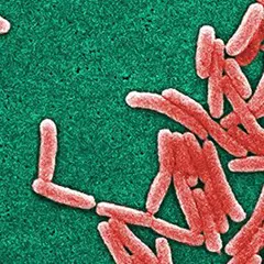 Deadly Legionnaire’s disease outbreak stopped by Xylem